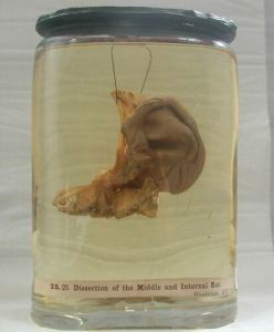 Dissection of the internal ear. Hunterian Museum & Art Gallery collections GLAHM 119612