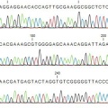 一些DNA测序的可视化使用CLC基因组工作台(由Caitlin Jukes提供)