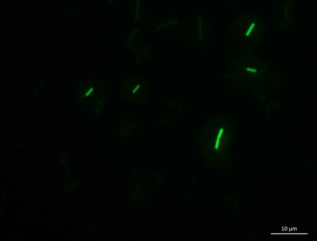 一些表达荧光蛋白的细菌（图片由Caitlin Jukes提供）